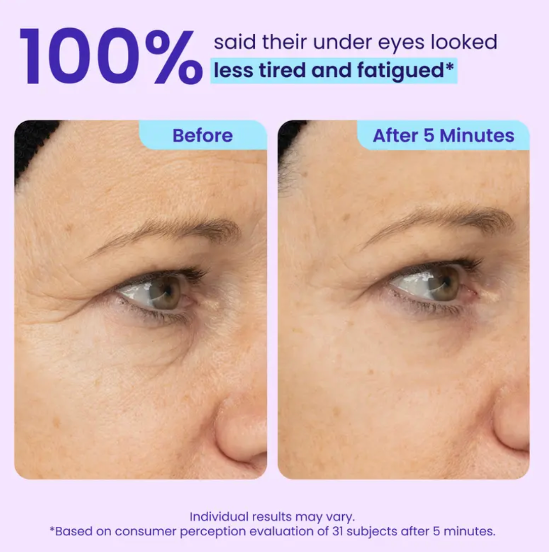 AVAA™ Instant Lift Eye Gel