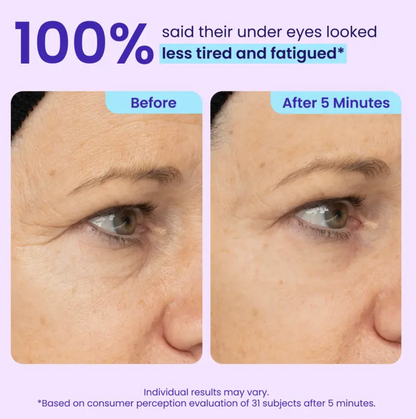 AVAA™ Instant Lift Eye Gel